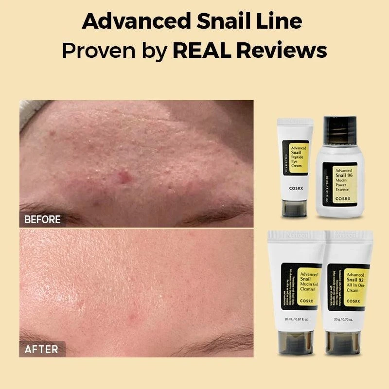 COSRX All About Snail Trial Kit (Korea) – 4 Step Korean Skincare Set for Glowing & Hydrated Skin 10 COSRX All About Snail Trial Kit (Korea) – 4 Step Korean Skincare Set for Glowing & Hydrated Skin - Image 10